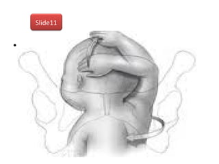 • ?
Slide11
 