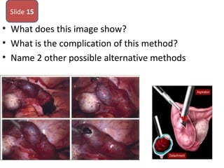 • What does this image show?
• What is the complication of this method?
• Name 2 other possible alternative methods
Slide 15
 