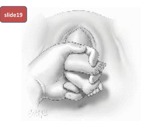slide19
 