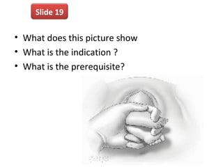 • What does this picture show
• What is the indication ?
• What is the prerequisite?
Slide 19
 