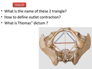 • What is the name of these 2 traingle?
• How to define outlet contraction?
• What is Thomas” dictum ?
Slide20
 