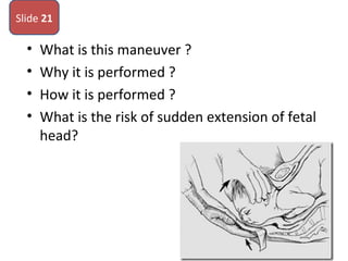 • What is this maneuver ?
• Why it is performed ?
• How it is performed ?
• What is the risk of sudden extension of fetal
head?
Slide 21
 