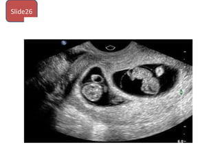 Slide26
 