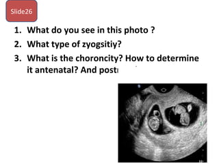 1. What do you see in this photo ?
2. What type of zyogsitiy?
3. What is the choroncity? How to determine
it antenatal? And postnatal
Slide26
 