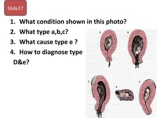 1. What condition shown in this photo?
2. What type a,b,c?
3. What cause type e ?
4. How to diagnose type
D&e?
Slide27
 