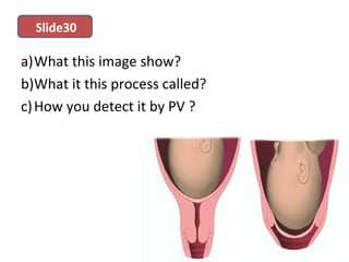 a)What this image show?
b)What it this process called?
c)How you detect it by PV ?
Slide30
 