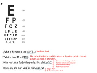 ophthalmology OSCE and spotters for MBBS | PPTX