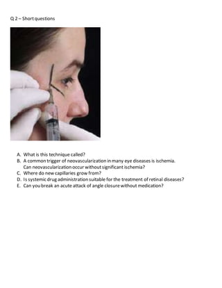 Optometry Instruments Osce Questions OSCE ophthalmology examination & answers | DOCX