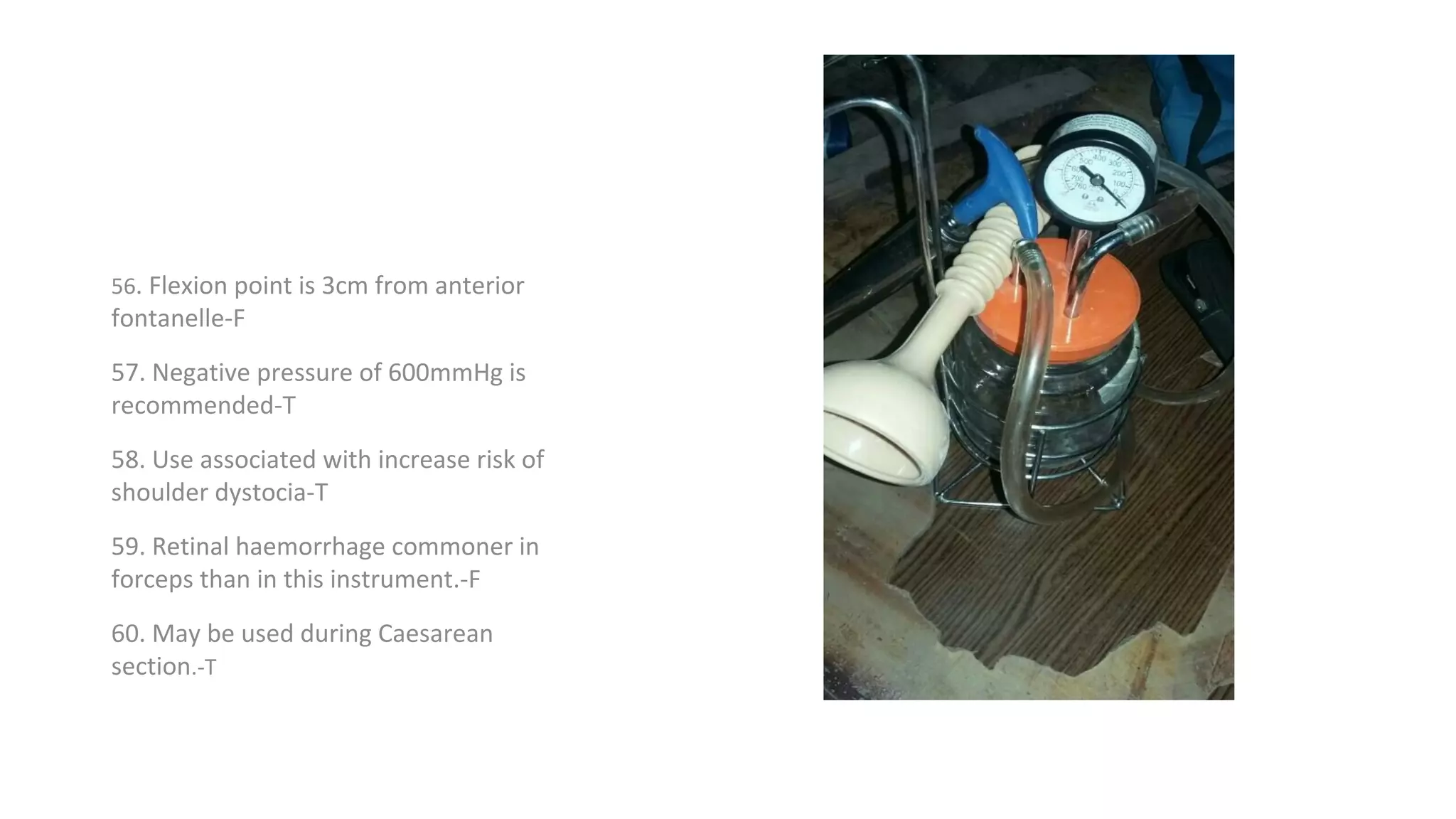 56. Flexion point is 3cm from anterior
fontanelle-F
57. Negative pressure of 600mmHg is
recommended-T
58. Use associated with increase risk of
shoulder dystocia-T
59. Retinal haemorrhage commoner in
forceps than in this instrument.-F
60. May be used during Caesarean
section.-T
 