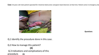 Case: 35 years old male patient operated for intestinal obstruction and given bowl diversion at that time. Patient come in emergency dep
Questions
Q.1 Identify the procedure done in this case.
Q.2 How to manage this patient?
(4)
Q.3 Indications and complications of this
procedure. (4)
 