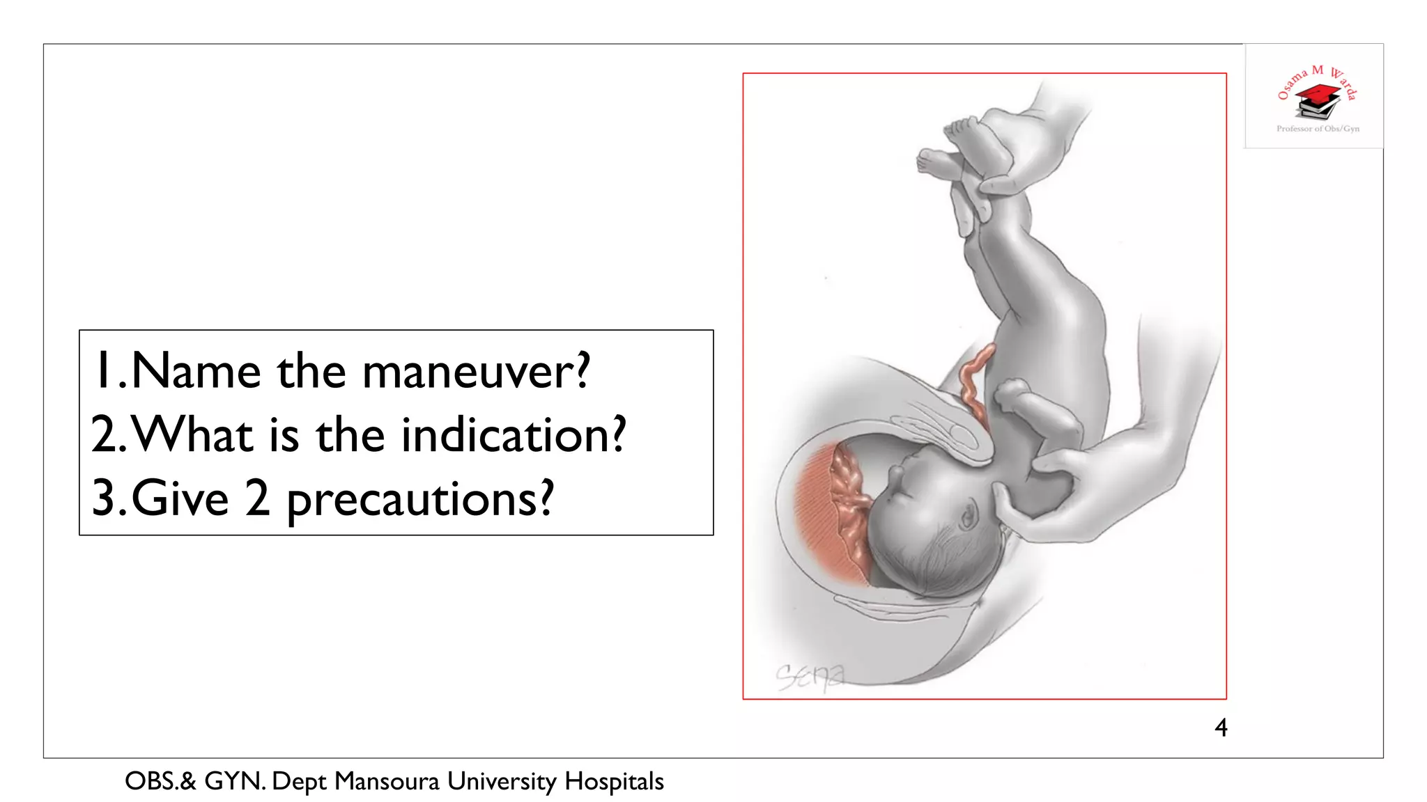OBSTETRICS & GYNECOLOGY- REVISION-2-WARDA | PDF