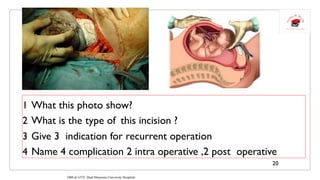 OBSTETRICS & GYNECOLOGY- REVISION-2-WARDA | PDF