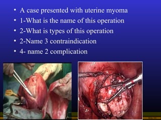 Operational Obstetrics & Gynecology · Bureau of Medicine and Surgery · 2000 Slide 101
• A case presented with uterine myom...