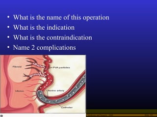 Operational Obstetrics & Gynecology · Bureau of Medicine and Surgery · 2000 Slide 102
• What is the name of this operation...
