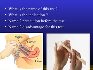 Operational Obstetrics & Gynecology · Bureau of Medicine and Surgery · 2000 Slide 116
• What is the name of this test?
• W...