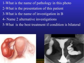 Operational Obstetrics & Gynecology · Bureau of Medicine and Surgery · 2000 Slide 125
1-What is the name of pathology in t...