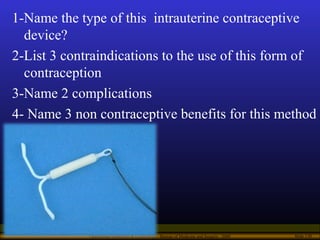Operational Obstetrics & Gynecology · Bureau of Medicine and Surgery · 2000 Slide 130
1-Name the type of this intrauterine...