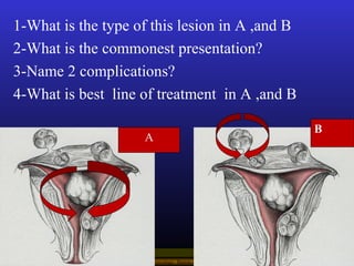 Operational Obstetrics & Gynecology · Bureau of Medicine and Surgery · 2000 Slide 134
1-What is the type of this lesion in...