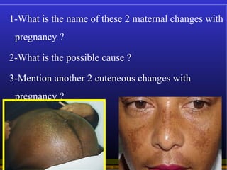 Operational Obstetrics & Gynecology · Bureau of Medicine and Surgery · 2000 Slide 16
1-What is the name of these 2 materna...