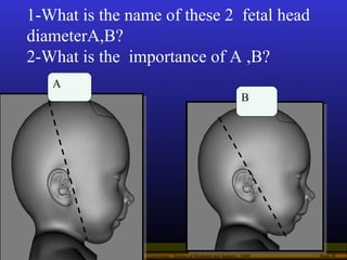 Operational Obstetrics & Gynecology · Bureau of Medicine and Surgery · 2000 Slide 20
1-What is the name of these 2 fetal h...