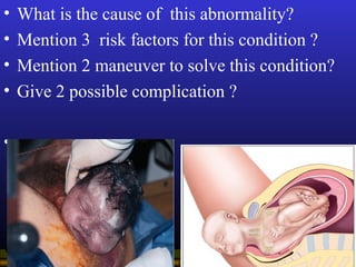 Operational Obstetrics & Gynecology · Bureau of Medicine and Surgery · 2000 Slide 26
• What is the cause of this abnormali...