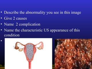 Operational Obstetrics & Gynecology · Bureau of Medicine and Surgery · 2000 Slide 32
• Describe the abnormality you see in...
