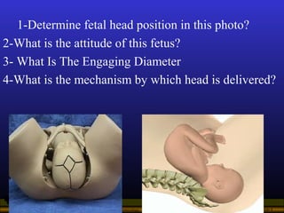 Operational Obstetrics & Gynecology · Bureau of Medicine and Surgery · 2000 Slide 4
1-Determine fetal head position in thi...