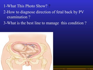 Operational Obstetrics & Gynecology · Bureau of Medicine and Surgery · 2000 Slide 46
1-What This Photo Show? ?
2-How to di...