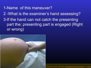 Operational Obstetrics & Gynecology · Bureau of Medicine and Surgery · 2000 Slide 51
1-Name of this maneuver?
2 -What is t...