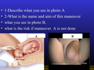 Operational Obstetrics & Gynecology · Bureau of Medicine and Surgery · 2000 Slide 57
• 1-Describe what you see in photo A
...