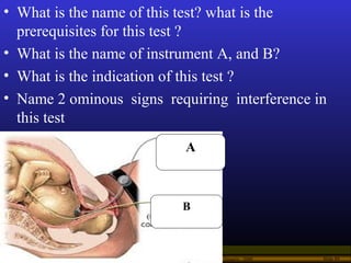 Operational Obstetrics & Gynecology · Bureau of Medicine and Surgery · 2000 Slide 80
• What is the name of this test? what...