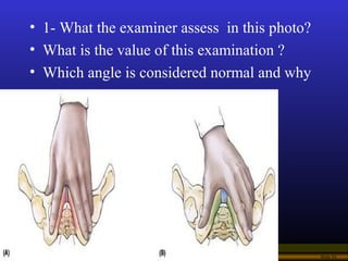 Operational Obstetrics & Gynecology · Bureau of Medicine and Surgery · 2000 Slide 84
• 1- What the examiner assess in this...