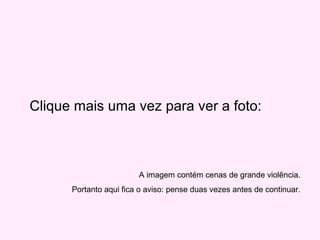 Clique mais uma vez para ver a foto:
A imagem contém cenas de grande violência.
Portanto aqui fica o aviso: pense duas vezes antes de continuar.
 