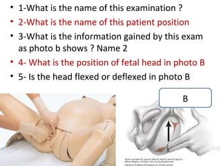 OSCE student exam in Obstetrics &Gynecology Zagazig University 2014 | PPT