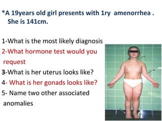 *A 19years old girl presents with 1ry amenorrhea .
She is 141cm.
1-What is the most likely diagnosis
2-What hormone test w...