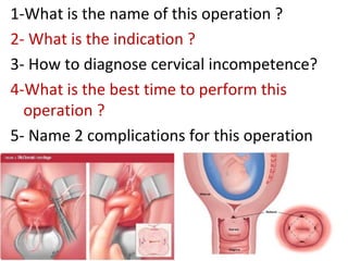 1-What is the name of this operation ?
2- What is the indication ?
3- How to diagnose cervical incompetence?
4-What is the...