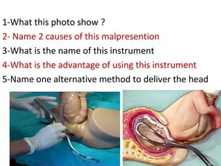 1-What this photo show ?
2- Name 2 causes of this malpresention
3-What is the name of this instrument
4-What is the advant...