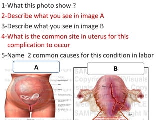 1-What this photo show ?
2-Describe what you see in image A
3-Describe what you see in image B
4-What is the common site i...