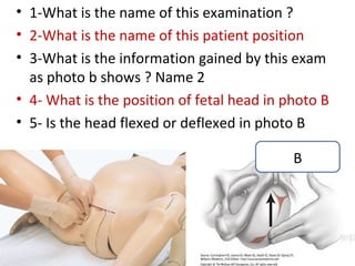 • 1-What is the name of this examination ?
• 2-What is the name of this patient position
• 3-What is the information gaine...