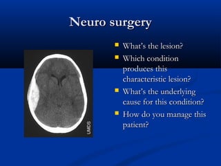 Neuro surgery
Neuro surgery
 What’s the lesion?
What’s the lesion?
 Which condition
Which condition
produces this
produces this
characteristic lesion?
characteristic lesion?
 What’s the underlying
What’s the underlying
cause for this condition?
cause for this condition?
 How do you manage this
How do you manage this
patient?
patient?
 