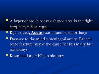  A hyper dense, biconvex shaped area in the right
A hyper dense, biconvex shaped area in the right
tempero-parietal region.
tempero-parietal region.
 Right sided
Right sided, Acute
, Acute Extra dural Haemorrhage
Extra dural Haemorrhage
 Damage to the middle meningeal artery. Parietal
Damage to the middle meningeal artery. Parietal
bone fracture maybe the cause for this injury but
bone fracture maybe the cause for this injury but
not always.
not always.
 Resuscitation, HIO, craniotomy
Resuscitation, HIO, craniotomy
 