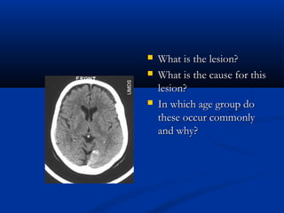  What is the lesion?
What is the lesion?
 What is the cause for this
What is the cause for this
lesion?
lesion?
 In which age group do
In which age group do
these occur commonly
these occur commonly
and why?
and why?
 