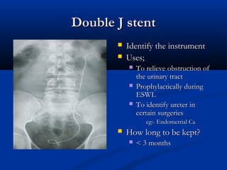 Double J stent
Double J stent
 Identify the instrument
Identify the instrument
 Uses;
Uses;
 To relieve obstruction of
To relieve obstruction of
the urinary tract
the urinary tract
 Prophylactically during
Prophylactically during
ESWL
ESWL
 To identify ureter in
To identify ureter in
certain surgeries
certain surgeries
eg:- Endometrial Ca
eg:- Endometrial Ca
 How long to be kept?
How long to be kept?
 < 3 months
< 3 months
 