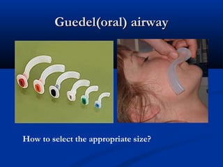 Guedel(oral) airway
Guedel(oral) airway
How to select the appropriate size?
 