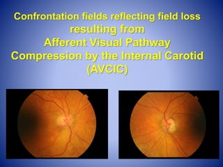 Routine Office Eye Checks for General Practitioners | PPTX