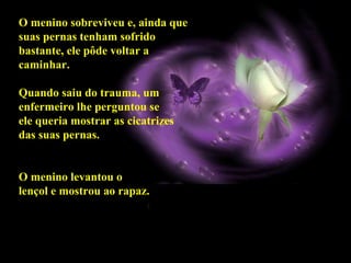 O menino sobreviveu e, ainda que
suas pernas tenham sofrido
bastante, ele pôde voltar a
caminhar.

Quando saiu do trauma, um
enfermeiro lhe perguntou se
ele queria mostrar as cicatrizes
das suas pernas.


O menino levantou o
lençol e mostrou ao rapaz.
 