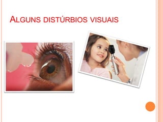ALGUNS DISTÚRBIOS VISUAIS
 