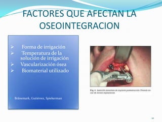 FACTORES QUE AFECTAN LA
            OSEOINTEGRACION
       Forma de irrigación
       Temperatura de la
       solución de irrigación
      Vascularización ósea
       Biomaterial utilizado




   Bränemark, Gutiérrez, Spiekerman




                                       10
 