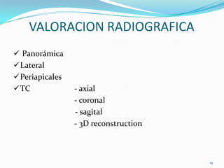 VALORACION RADIOGRAFICA
 Panorámica
 Lateral
 Periapicales
 TC             - axial
                 - coronal
                 - sagital
                 - 3D reconstruction



                                       14
 