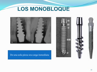 LOS MONOBLOQUE




De una sola pieza xra carga inmediata




                                        27
 